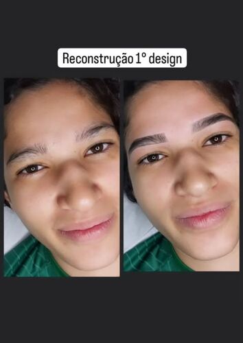 Antes e depois